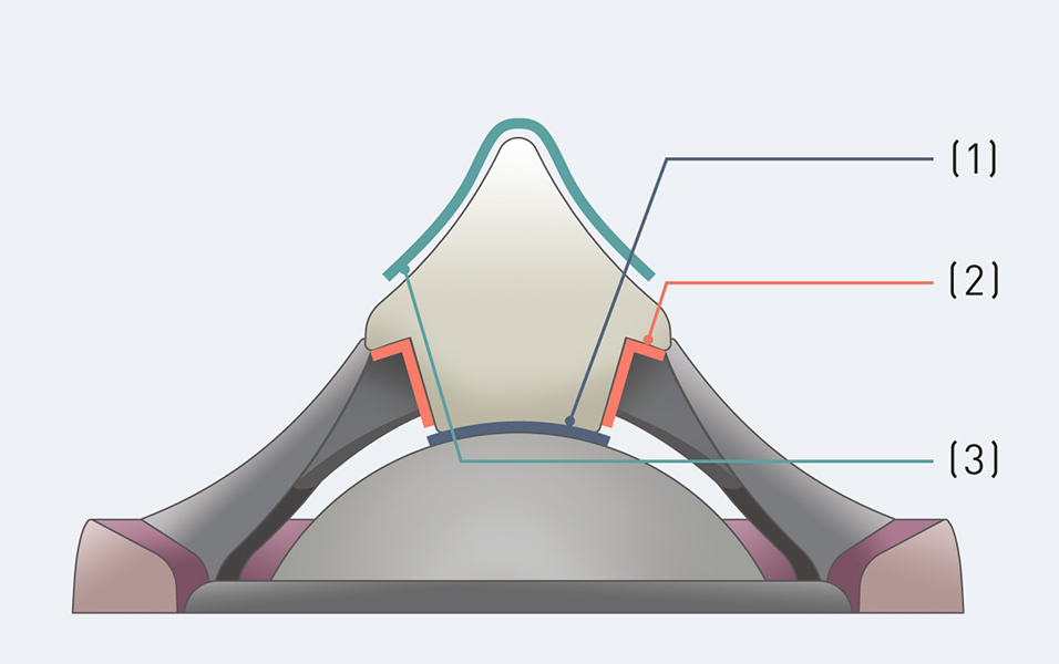 Cross section of Linear Phase Plug